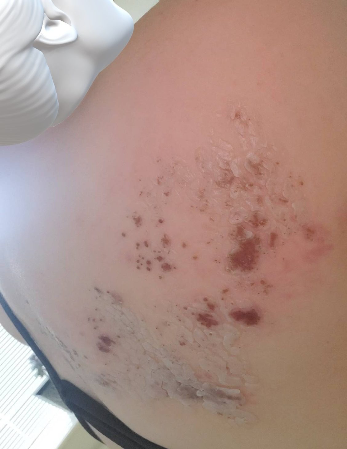 RMR-86 Instant Mold and Mildew Stain Remover Spray - Scrub Free Formula, 30 Fl Oz - Customer Photo 1