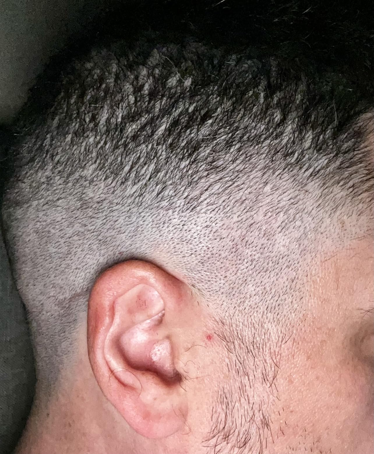 FADEKING® Professional Hair Clippers for Men - Cordless Hair Clippers, LCD Display Barber Clippers for Hair Cutting & Mens Grooming with Travel Case (Gold+Bronze) - Customer Photo 1