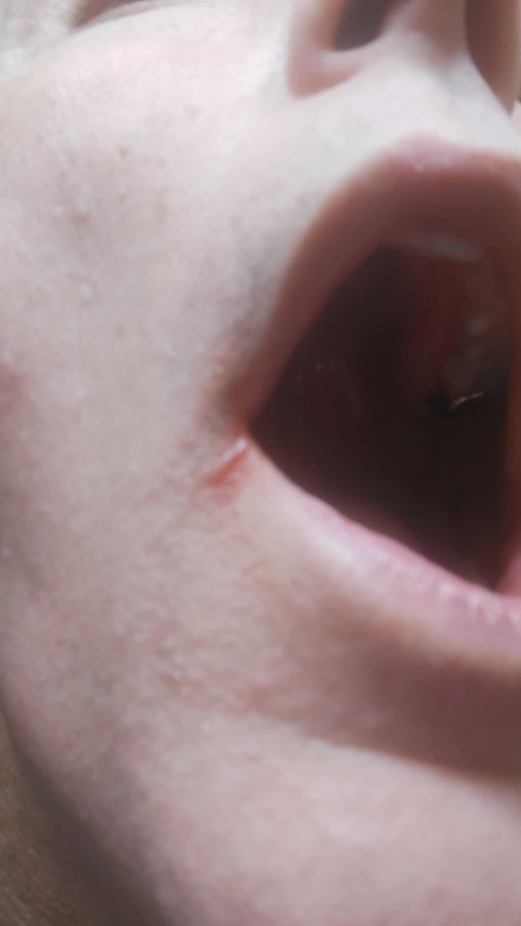 Philips Series 9000 - Customer Review Photo