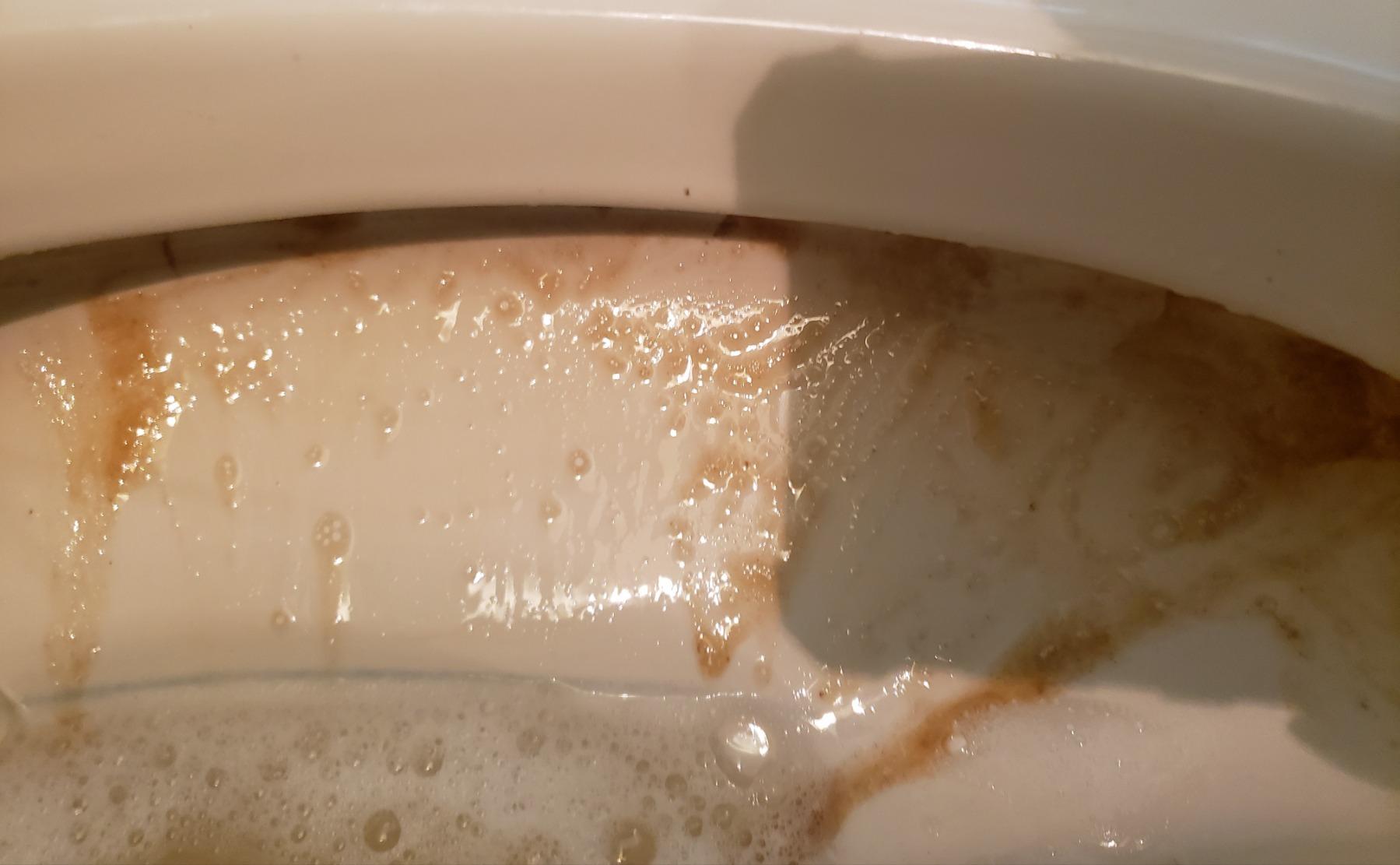 Better Life Toilet Bowl Cleaner, Plant-derived, Stain & Odor Remover, Tea Tree & Peppermint Scent Cleaning Gel, Liquid Bathroom Cleaners for Household, 24 Oz, Pack of 2 Customer Review Better Life Toilet Bowl Cleaner, Plant-derived, Stain & Odor Remover, Tea Tree & Peppermint Scent Cleaning Gel, Liquid Bathroom Cleaners for Household, 24 Oz, Pack of 2 - Customer Photo 1