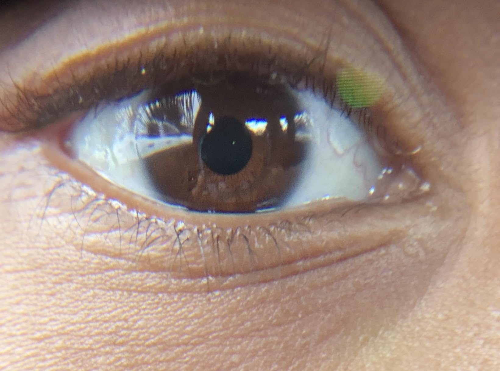 Xenvo Pro Lens Kit for iPhone and Android, Macro and Wide Angle Lens with LED Light - Customer Photo 2
