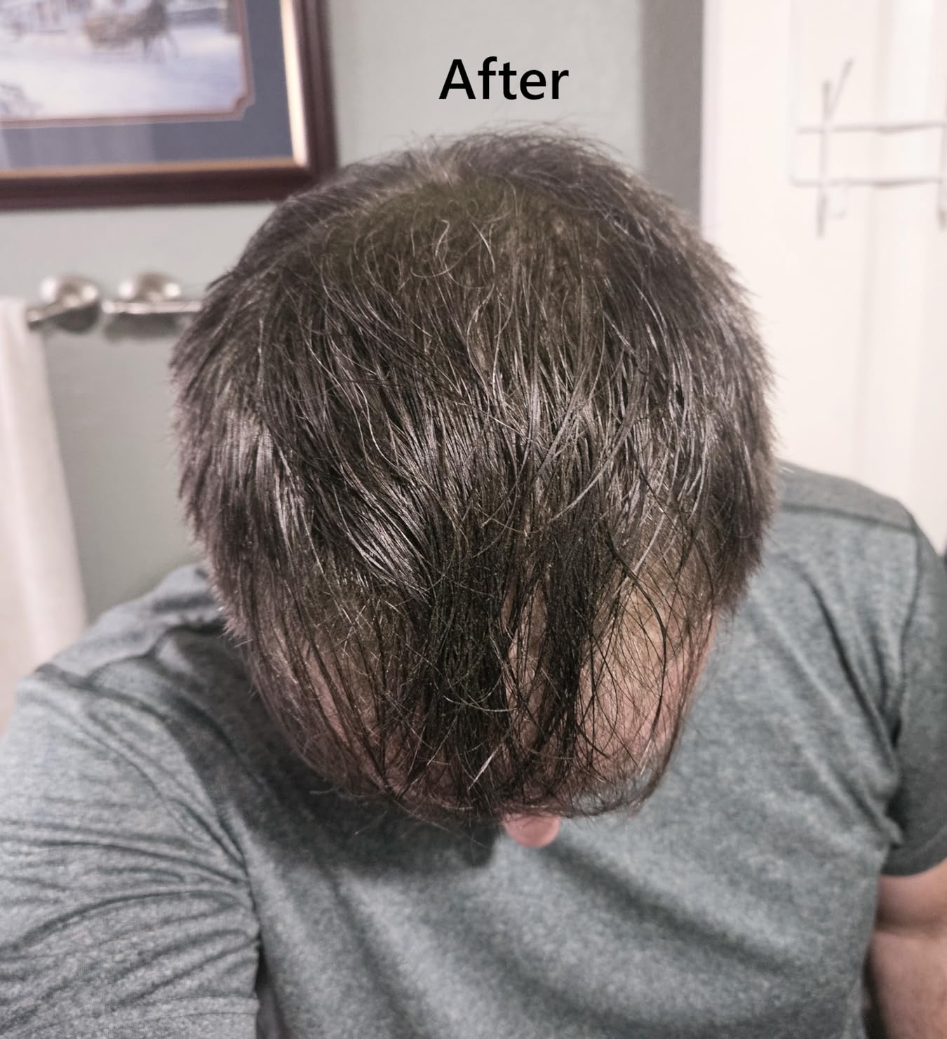 Toppik Hair Building Fibers, Fill In Fine or Thinning Hair Instantly Thicker, Fuller Looking Hair 9 Shades,4 size options customer photo 1