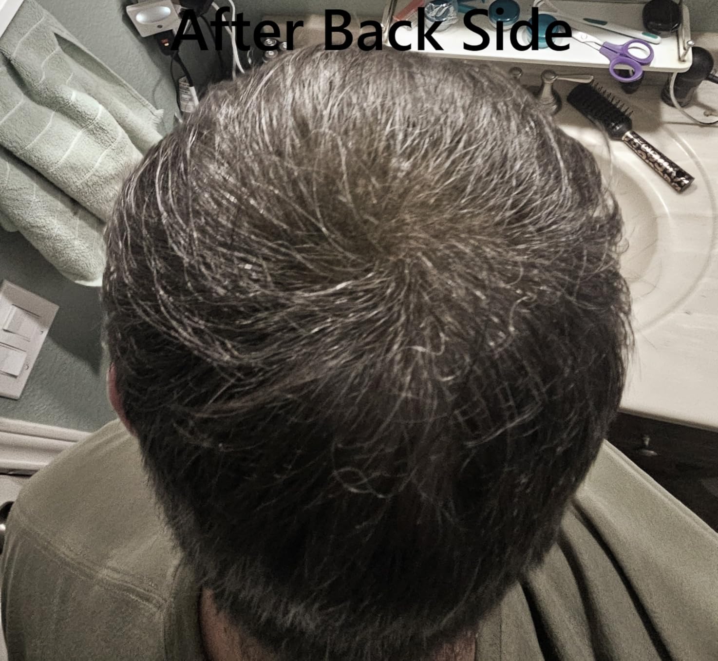 Toppik Hair Building Fibers, Fill In Fine or Thinning Hair Instantly Thicker, Fuller Looking Hair 9 Shades,4 size options customer photo 2