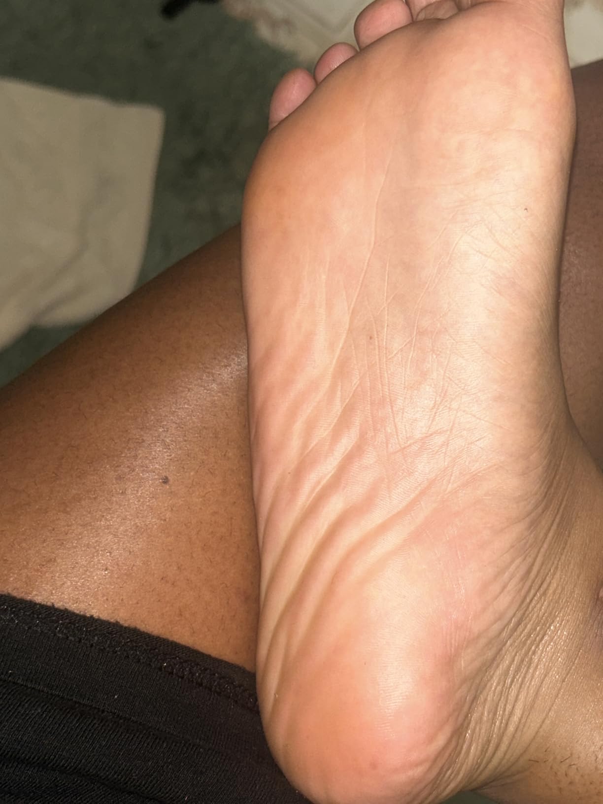 Gold Bond Softening Foot Cream, 4 oz., Foot Lotion with Shea Butter to Soften Rough & Dry Feet customer photo 1