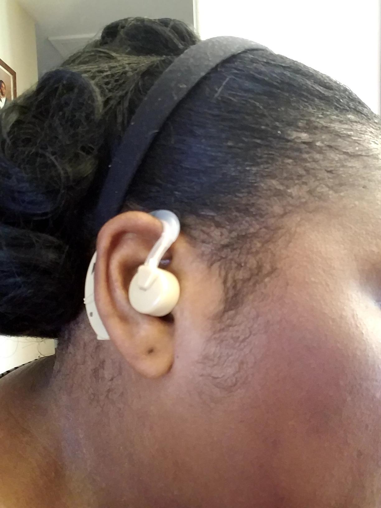 MEDca Hearing Amplifiers - Digital BTE Personal Sound Amplifier w/Noise Reduction & Volume Control, LR44 Battery Powered, 3 Ear Domes, Left or Right Use, Small & Discreet customer photo 1