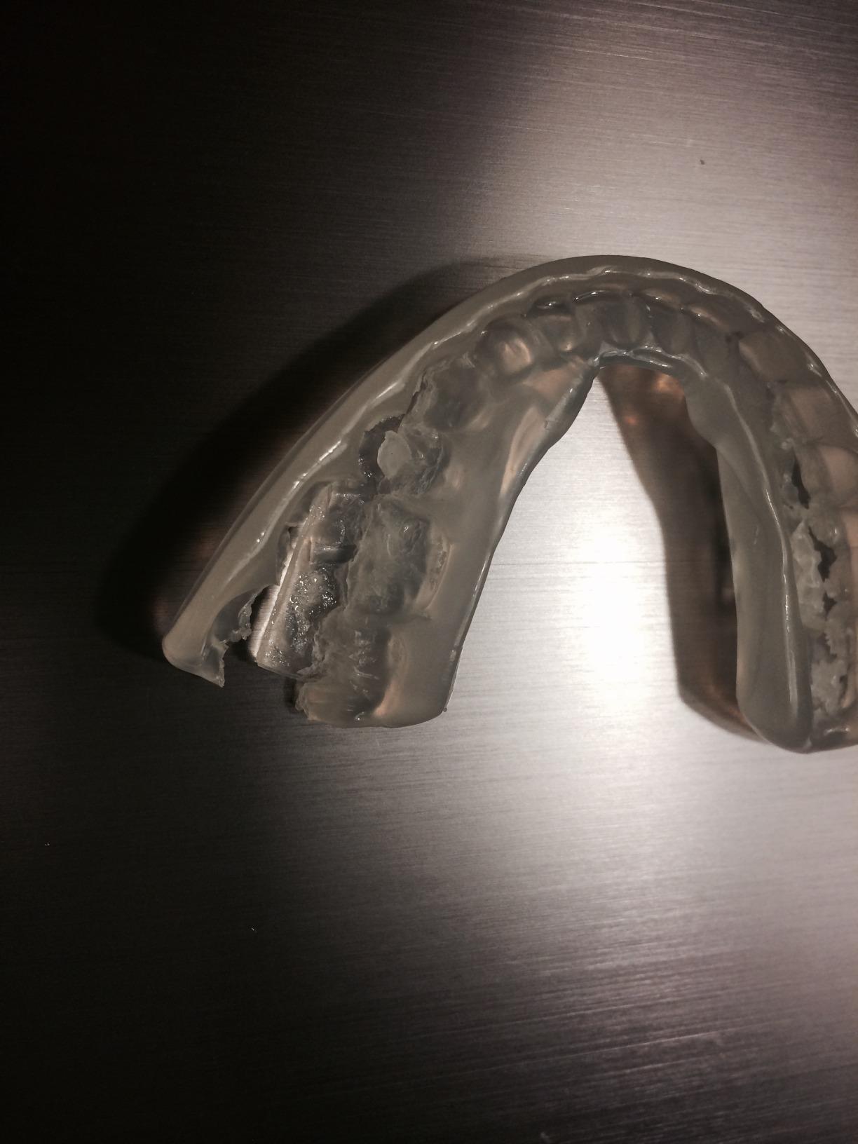 DenTek Professional Fit Dental Guard | Maximum Protection | 1-Pack customer photo 2