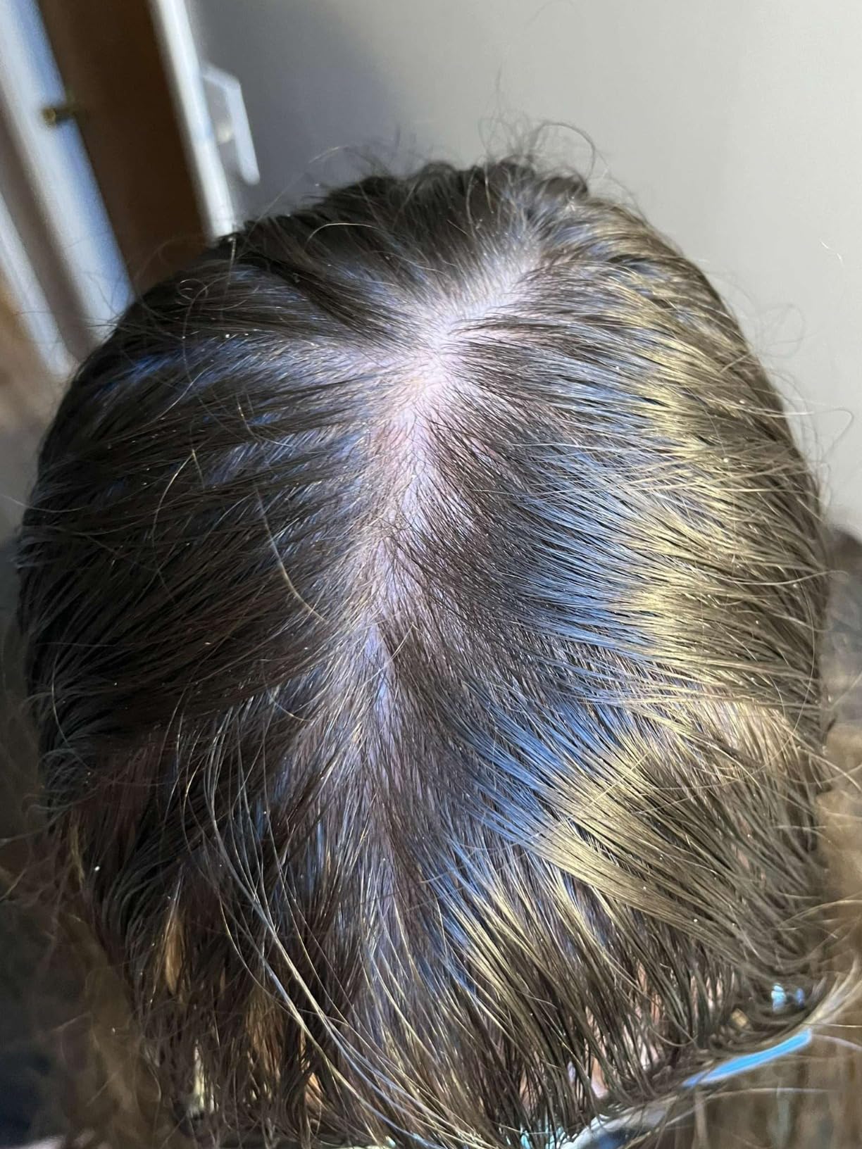LUXE Hair Building Fibers - Thickening Fibers - CONFIDENCE IN A JAR - 2 + Months Supply - Hypoallergenic, Dermatologist Tested - Multiple Colors Available (Black) customer photo 1