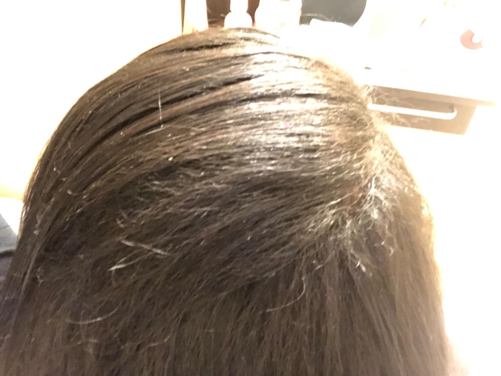 CROWN Hair Building Fibers (28g) - Instantly Cover Fine & Thinning Hair for a Thicker, Fuller Look - A Natural Keratin Concealer - 13 Shades for Men & Women - Dark Brown customer photo 1