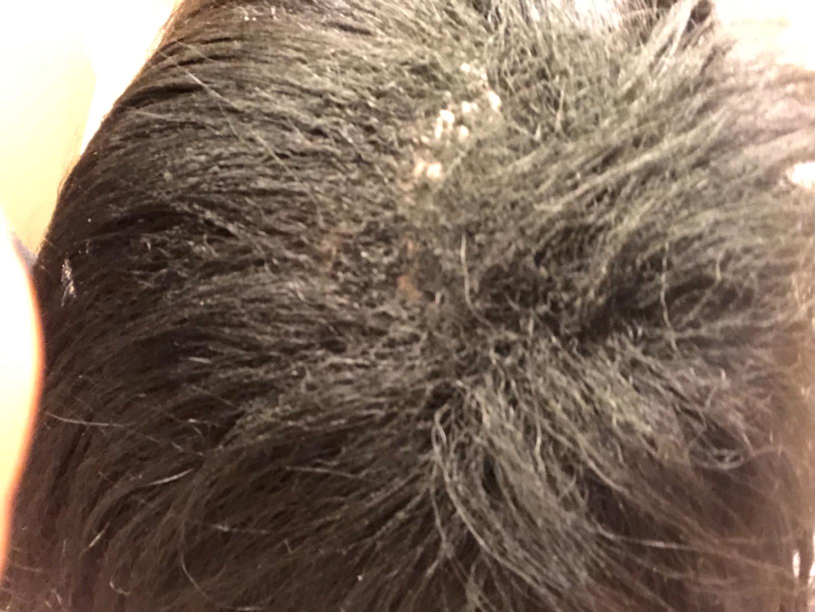 CROWN Hair Building Fibers (28g) - Instantly Cover Fine & Thinning Hair for a Thicker, Fuller Look - A Natural Keratin Concealer - 13 Shades for Men & Women - Dark Brown customer photo 2