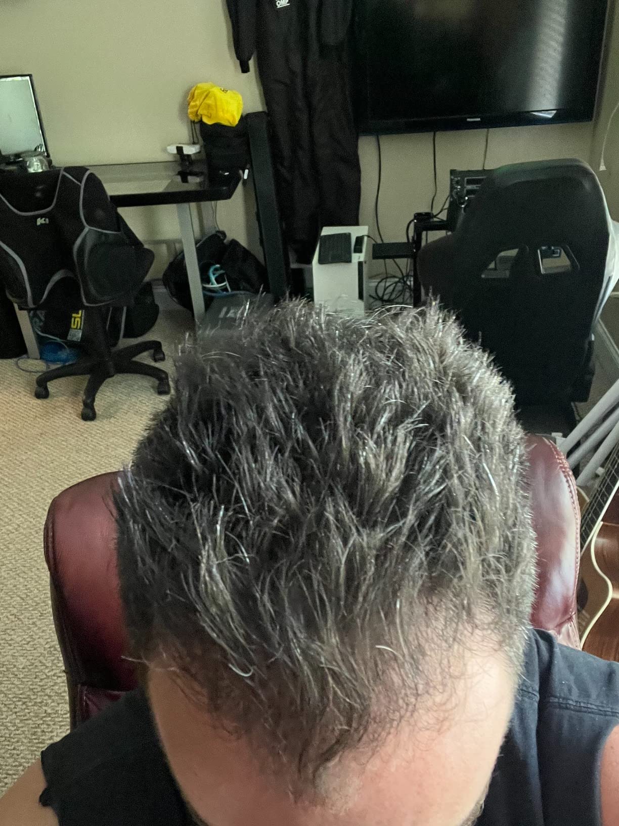 iRestore Professional Laser Red Light Therapy for Hair Growth System - FDA Cleared Hair Loss, Hair Thinning & Alopecia Treatment for Men & Women - 282 Lasers & LEDs customer photo 1