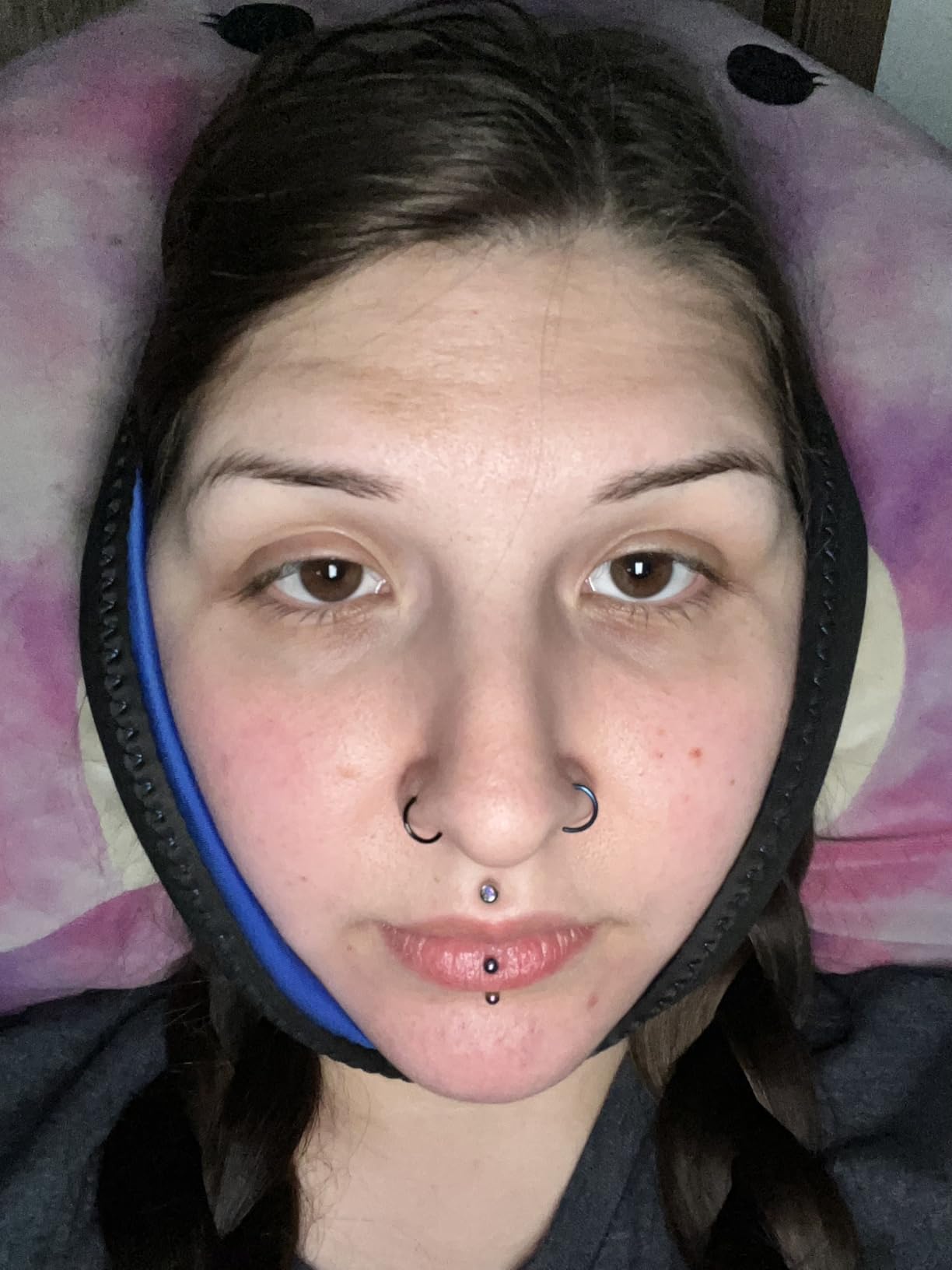 NEWGO Wisdom Teeth Ice Pack Head Wrap for Face Oral Surgery, FSA Eligible, Jaw Ice Pack for Face with 4 Hot Cold Gel Pack for TMJ, Tooth Extraction, Tonsillectomy Recovery customer photo 2