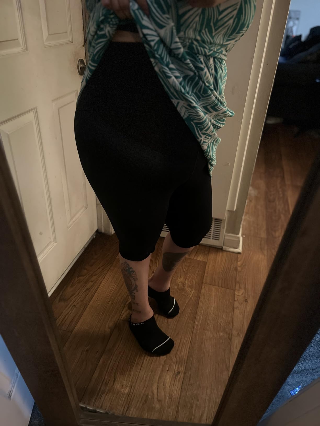 Mojo Compression Shorts 20-30mmHg, Graduated Support for Lymphedema, Lipedema & Edema, Pre/Post-Surgery customer photo 1