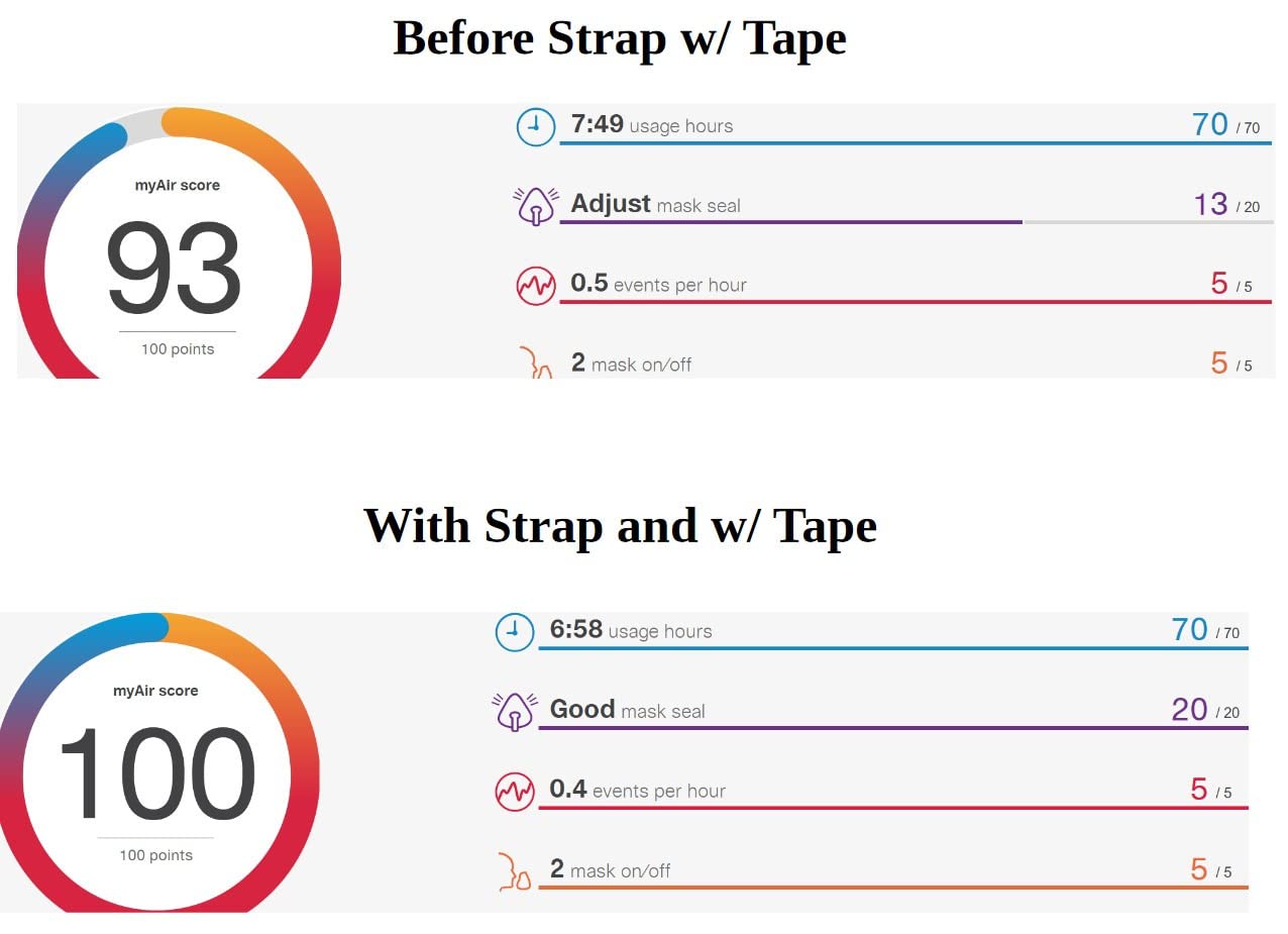 Anti Snore Chin Strap - Anti-Dry Mouth Chin Strap for CPAP Users - Stop Noise - Snoreless Sleeping Solution for Men and Women - Breathing Aid for Snoring customer photo 1