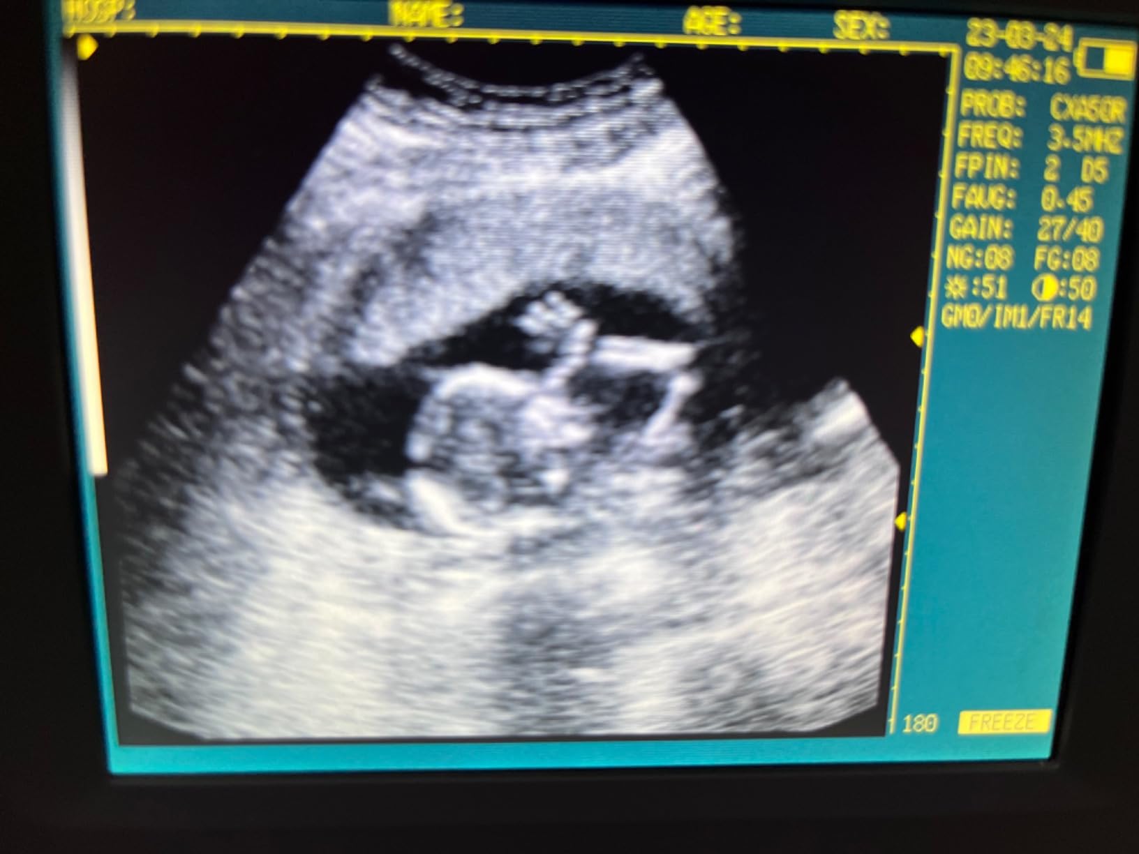 Ultrasound Scanner Veterinary V16 with 3.5 MHz Convex Probe for Pregnancy Test on Dogs, Sheep and Pigs customer photo 1