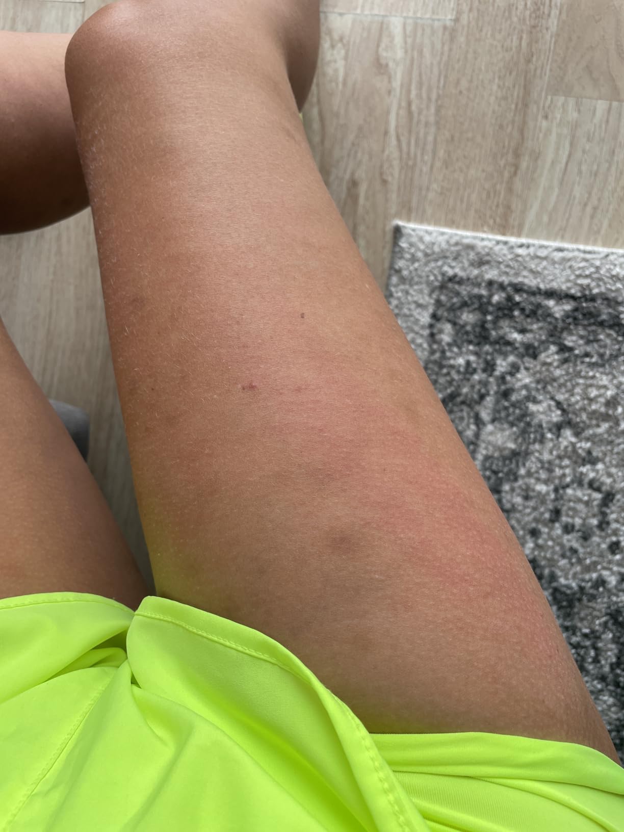 TESMED Cellulite Manual Massager: Made in Italy, Patented with Converging & Diverging Roller Technology. Anti Cellulite Roller for Thighs and Buttock customer photo 2