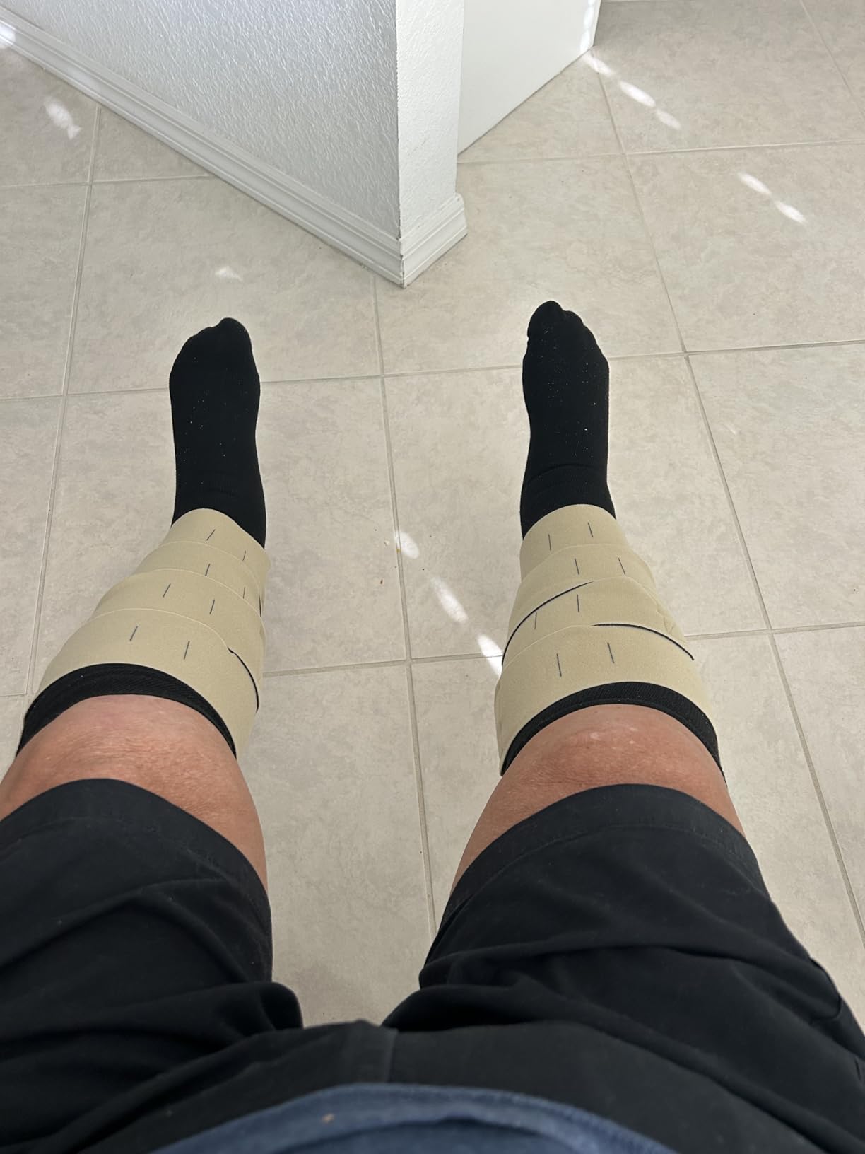 CircAid Juxtalite Lower Leg System - Easy to Use Adjustable Compression Level Garment for Men & Women, Leg Circulation, Compatible with Elastic Stockings customer photo 1