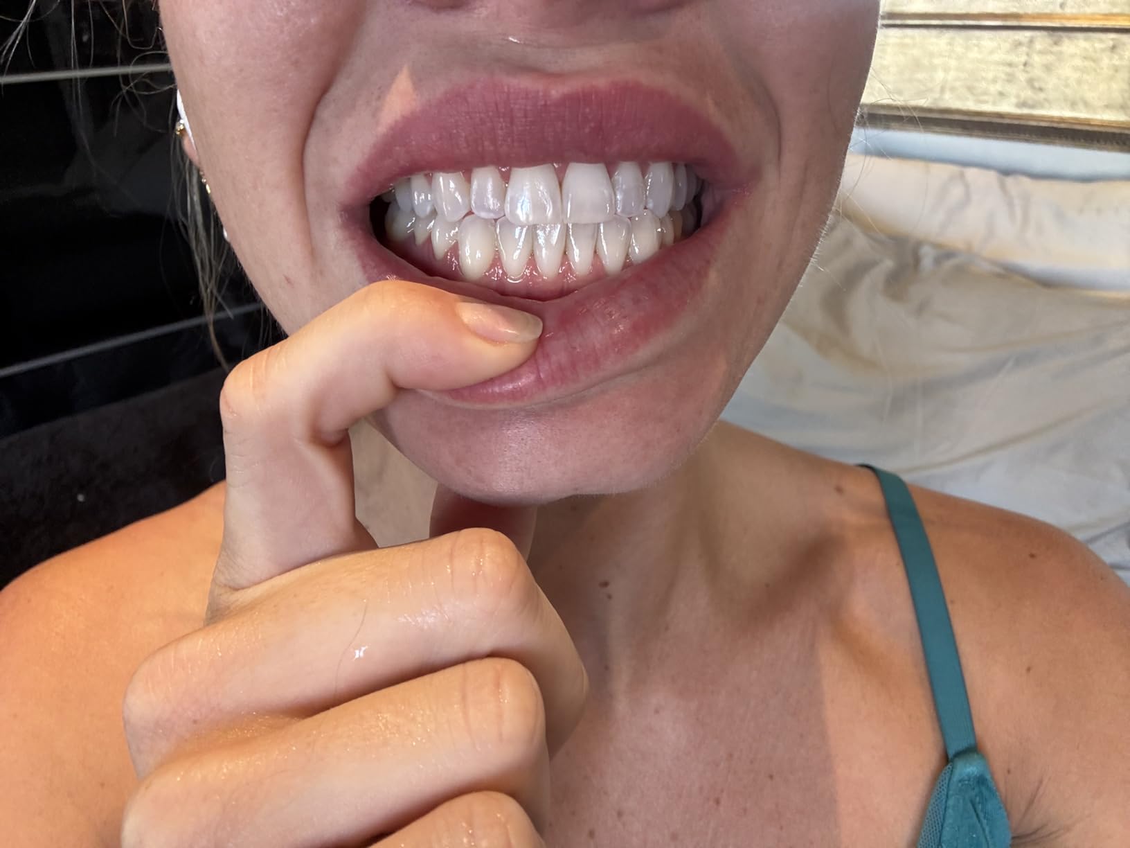 Opalescence Whitening Bundle - Opalescence Go 15% Hydrogen Peroxide Prefilled Whitening Trays and Whitening Toothpaste - Mint Flavor 5194-5166 customer photo 2