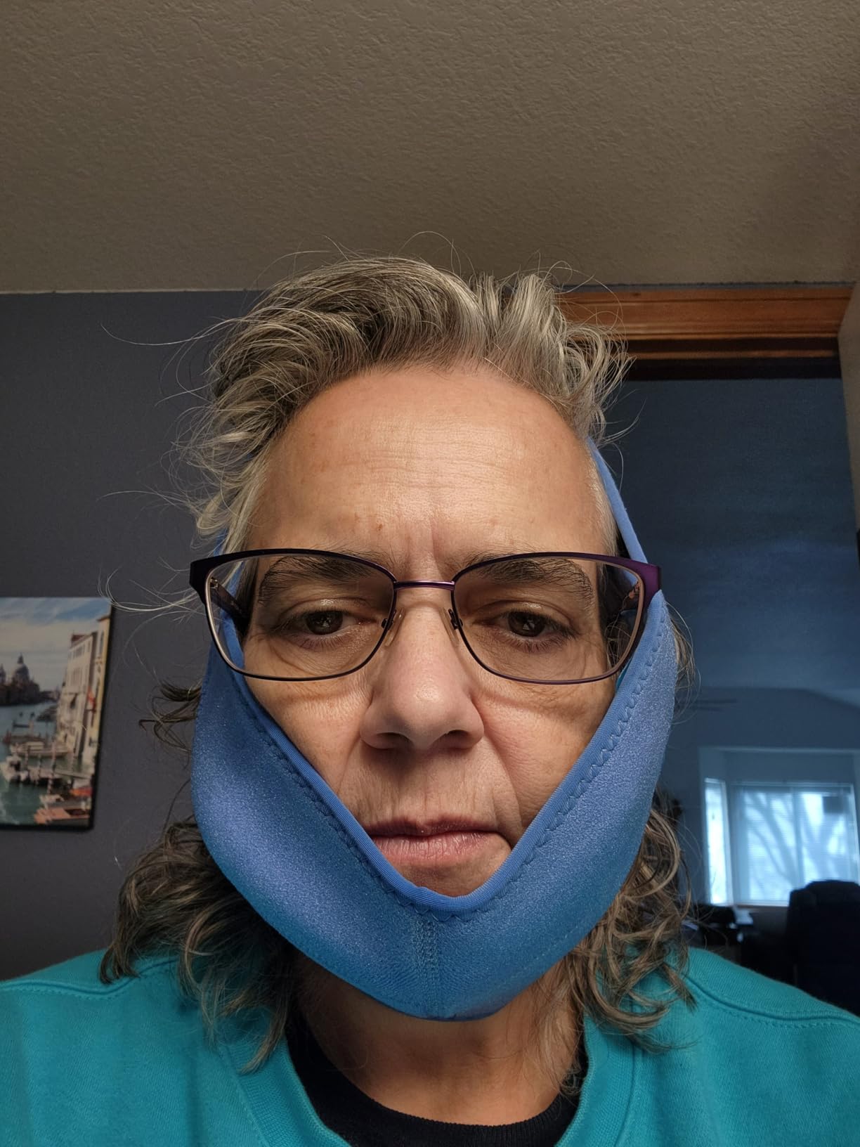 REVIX Wisdom Teeth Ice Pack Head Wrap with 3D Sewing Jaw Ice Pack for Face Oral Surgery Pain Relief for TMJ, Tooth Extraction & Teeth Removed, Extra Snug Fit with 4 Hot Cold Gel Packs Reusable, Black customer photo 2