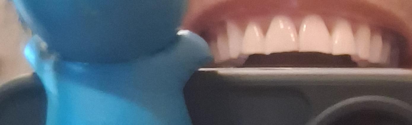 Crest 3D Whitestrips Sensitive & Gentle + LED Light - Teeth Whitening Kit, 1 Light + 14 Treatments, Each with 1 Upper/1Lower, 28 Strips - Crest 3DWhite Teeth Whitening Strips customer photo 1