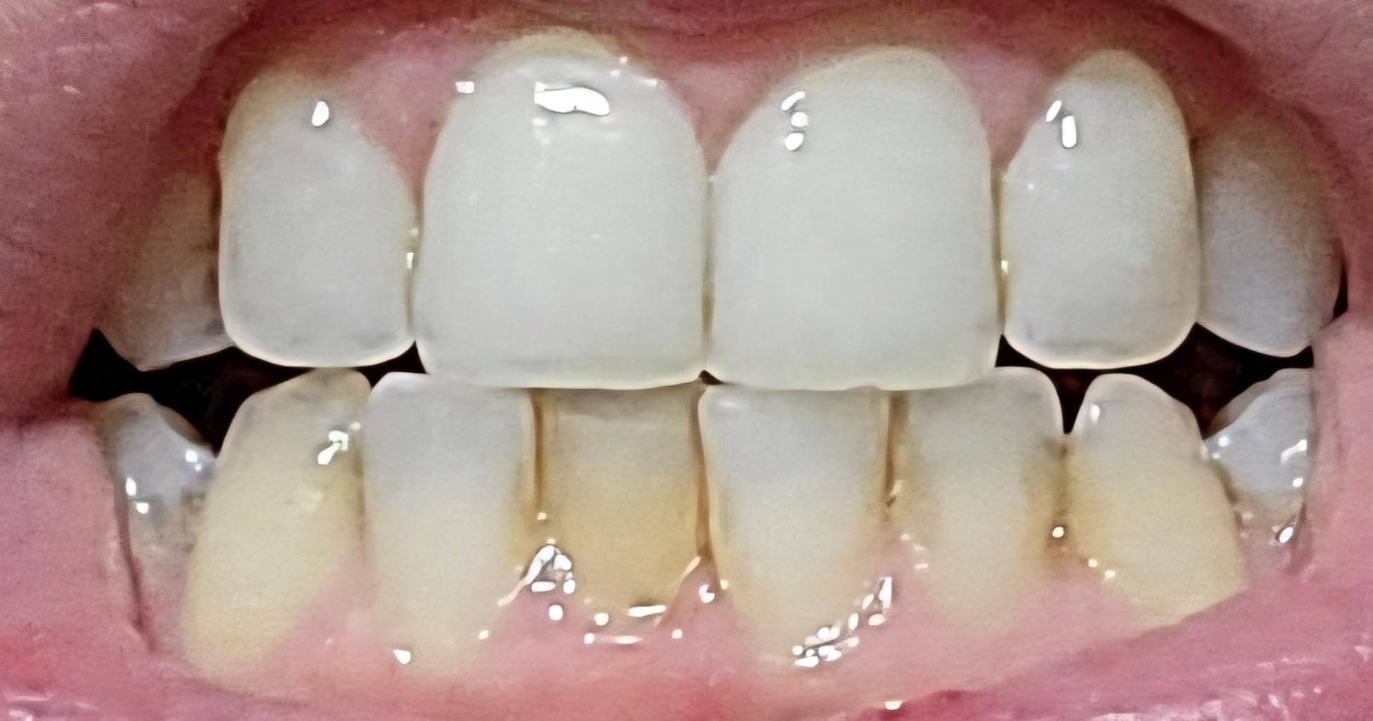 GuruNanda Hydroxyapatite Toothpaste, SLS & Fluoride Free, Whitening Toothpaste with Tongue Scraper & Squeezer - Freshens Breath, Fights Plaque - Natural CocoMint Jasmine Neem, 4.2oz customer photo 1