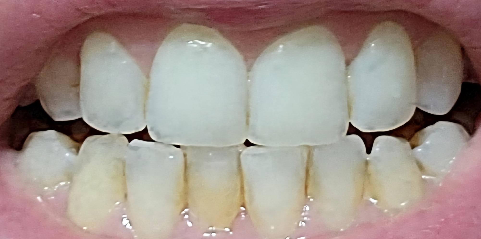 GuruNanda Hydroxyapatite Toothpaste, SLS & Fluoride Free, Whitening Toothpaste with Tongue Scraper & Squeezer - Freshens Breath, Fights Plaque - Natural CocoMint Jasmine Neem, 4.2oz customer photo 2