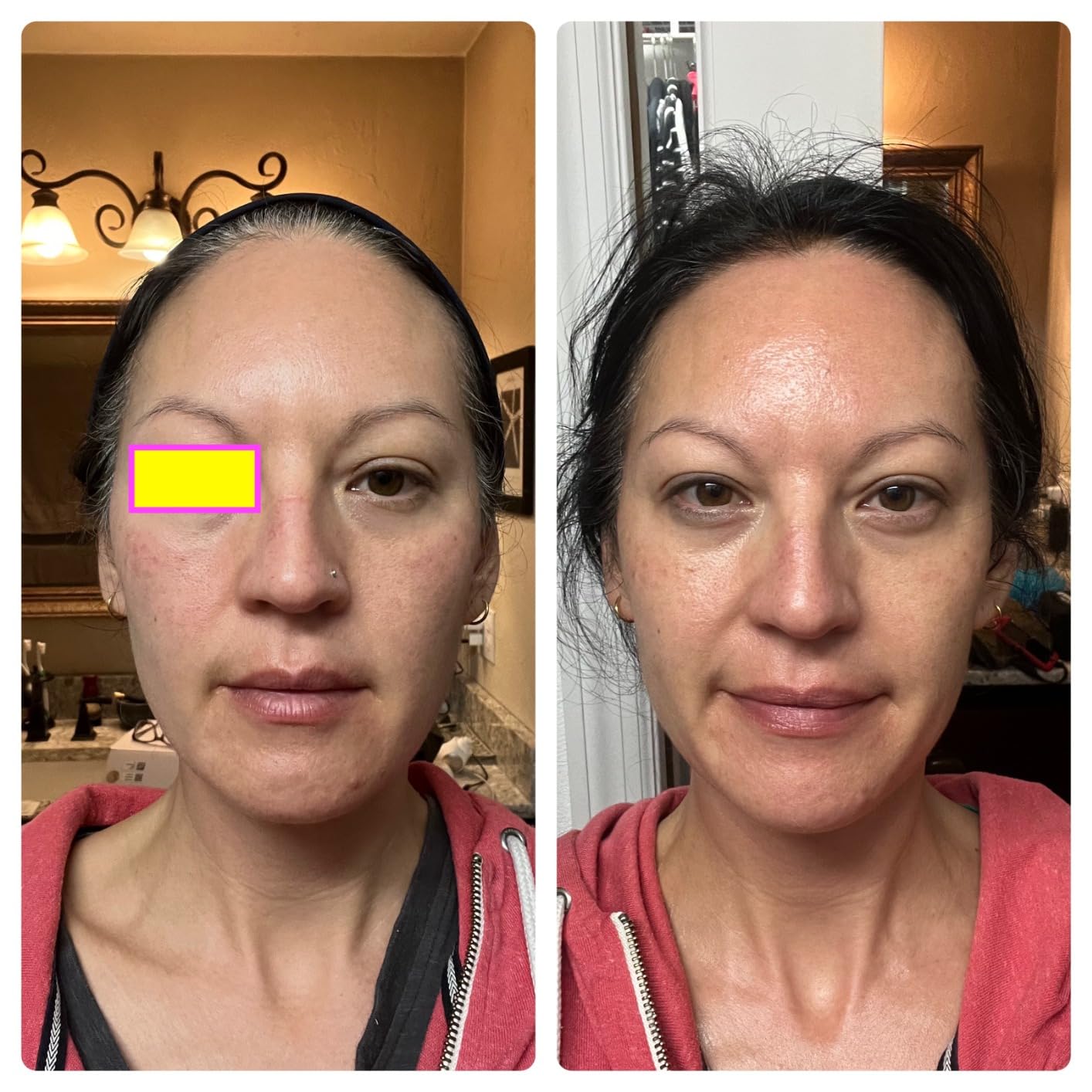 TheraFace PRO by Therabody - Microcurrent Facial Device, 8-in-1 Compact Face Massager & Facial Sculpting Tool with Light Therapy for Skin Tightening, Anti Wrinkle, Anti Aging & Skin Care (Black) customer photo 1