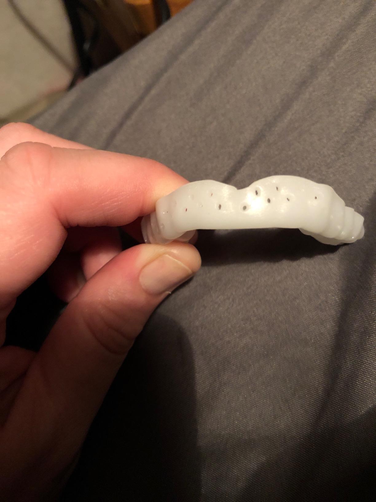 Nighttime Dental Protector - Comfortable Mouth Guard for Bruxism - Custom Fitted Protection for Teeth Grinding and Jaw Clenching Plus Storage Case customer photo 2