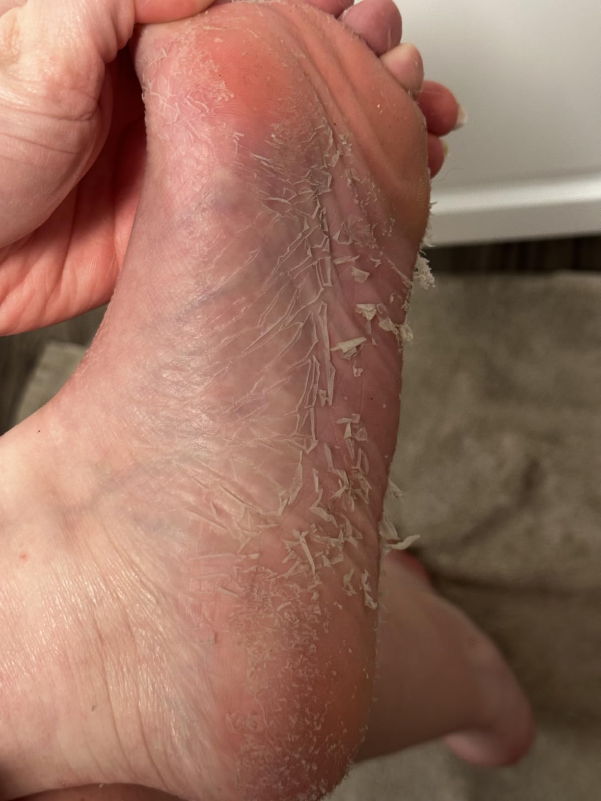 2 Pairs Foot Peel Mask Exfoliant for Soft Feet in 1-2 Weeks, Exfoliating Booties for Peeling Off Calluses & Dead Skin, For Men & Women Lavender by BEALUZ customer photo 1