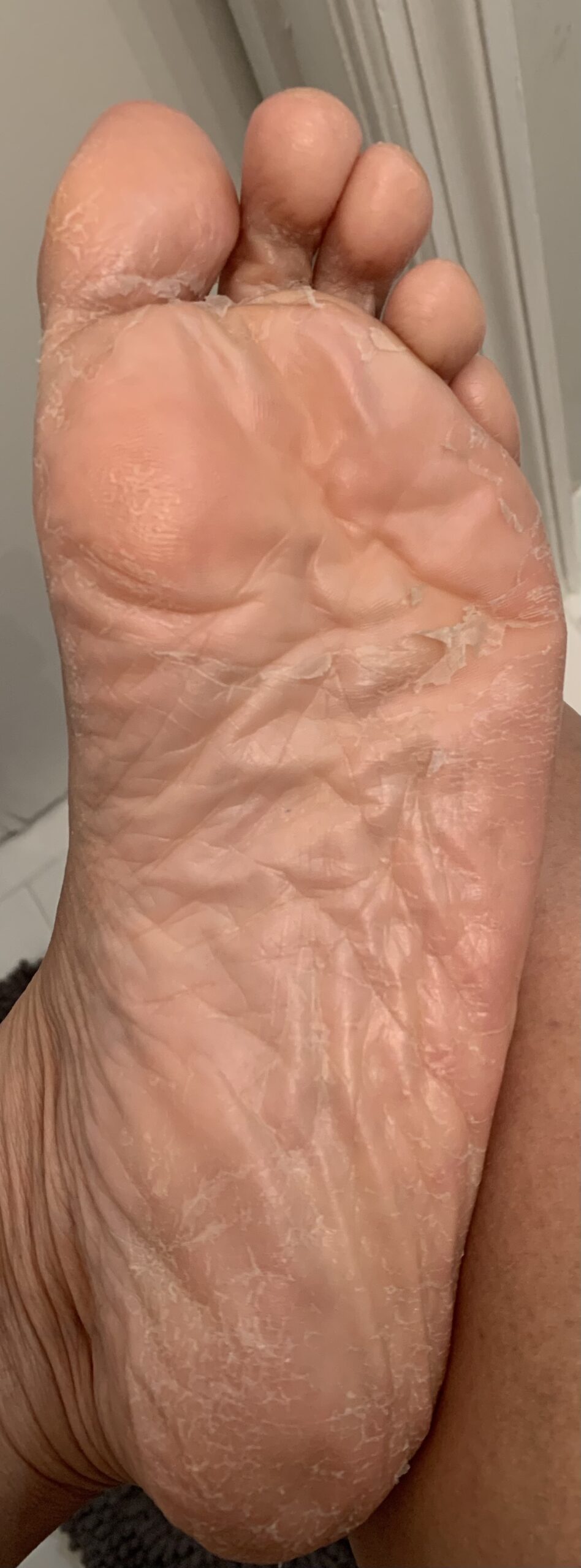 2 Pairs Foot Peel Mask Exfoliant for Soft Feet in 1-2 Weeks, Exfoliating Booties for Peeling Off Calluses & Dead Skin, For Men & Women Lavender by BEALUZ customer photo 2