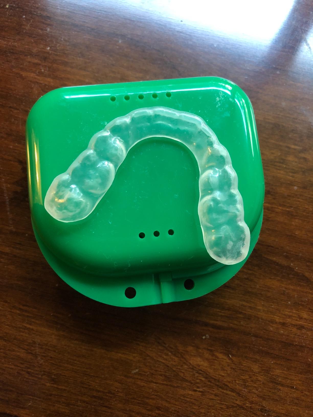 Encore - Custom Soft Dental Night Guard/Mouth Guard (One Guard) for Protection Against Teeth Grinding/Clenching/Bruxism (Upper or Lower) customer photo 2