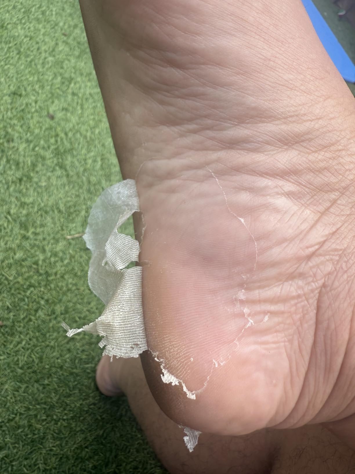 Baby Foot - Original Foot Peel Exfoliator For Men - Foot Peel Mask - Repair Rough Dry Cracked Feet and remove Dead Skin, Repair Heels and enjoy Baby Soft Smooth Feet 2.7 Fl. Oz. Mint Scented Pair customer photo 1