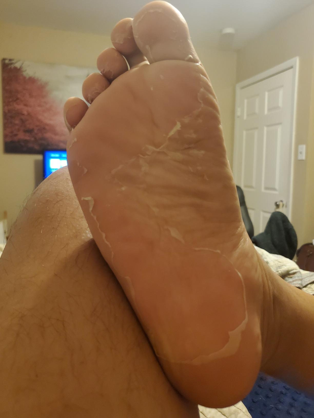 Baby Foot - Original Foot Peel Exfoliator For Men - Foot Peel Mask - Repair Rough Dry Cracked Feet and remove Dead Skin, Repair Heels and enjoy Baby Soft Smooth Feet 2.7 Fl. Oz. Mint Scented Pair customer photo 2