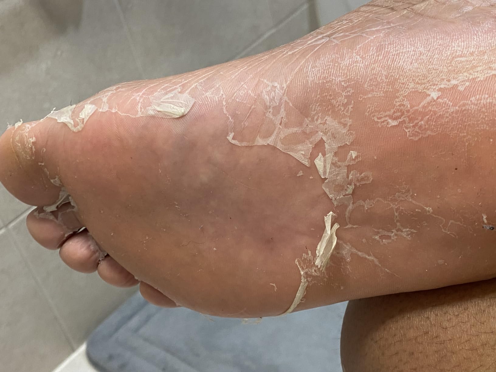 CÉLOR Foot Peeling Mask for Dry Cracked Feet | Foot Mask to Exfoliate Rough, Cracked, Dry Feet, Calluses for Soft Baby Feet Results | Made with Aloe Vera Extract for Women & Men (2 Pairs) | Lavender customer photo 1