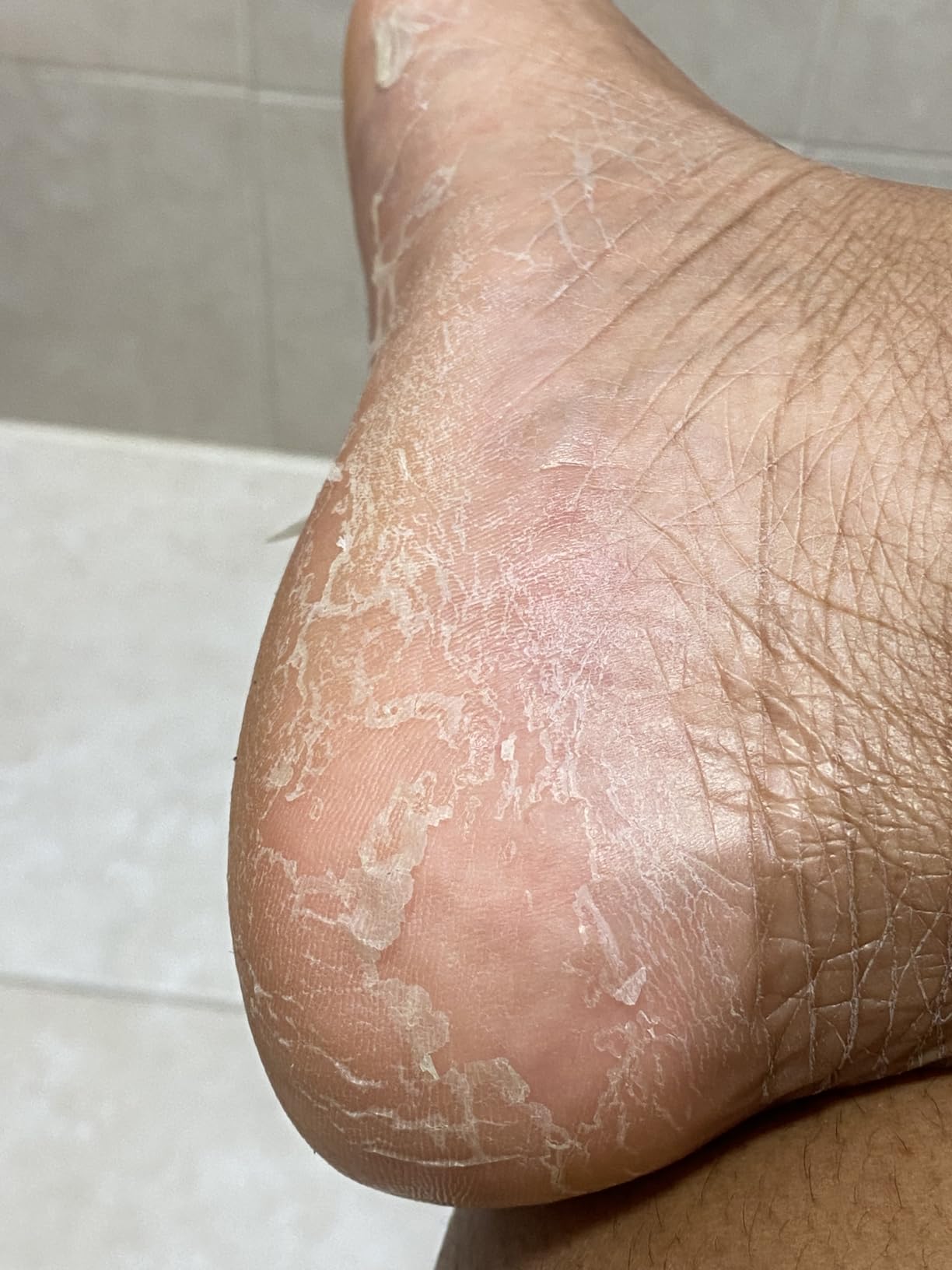 CÉLOR Foot Peeling Mask for Dry Cracked Feet | Foot Mask to Exfoliate Rough, Cracked, Dry Feet, Calluses for Soft Baby Feet Results | Made with Aloe Vera Extract for Women & Men (2 Pairs) | Lavender customer photo 2