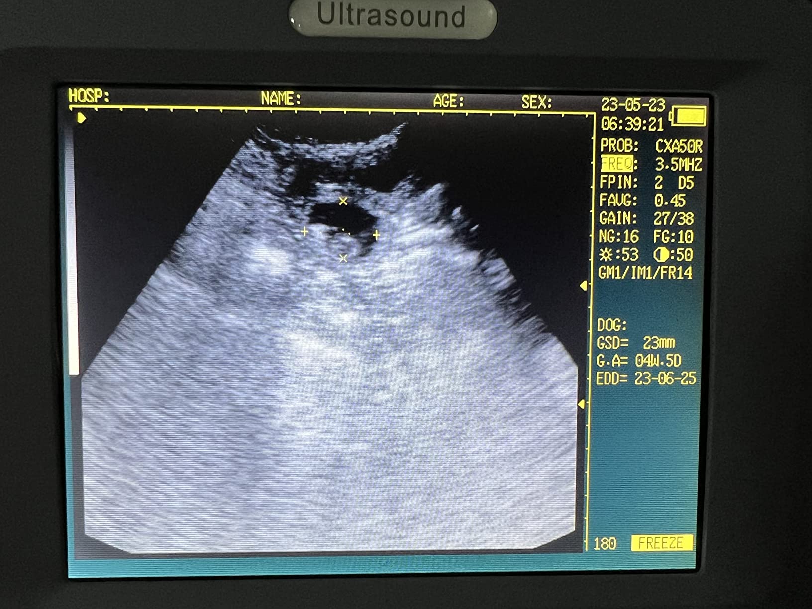 Ultrasound Scanner Veterinary V16 with 3.5 MHz Convex Probe for Pregnancy Test on Dogs, Sheep and Pigs customer photo 2