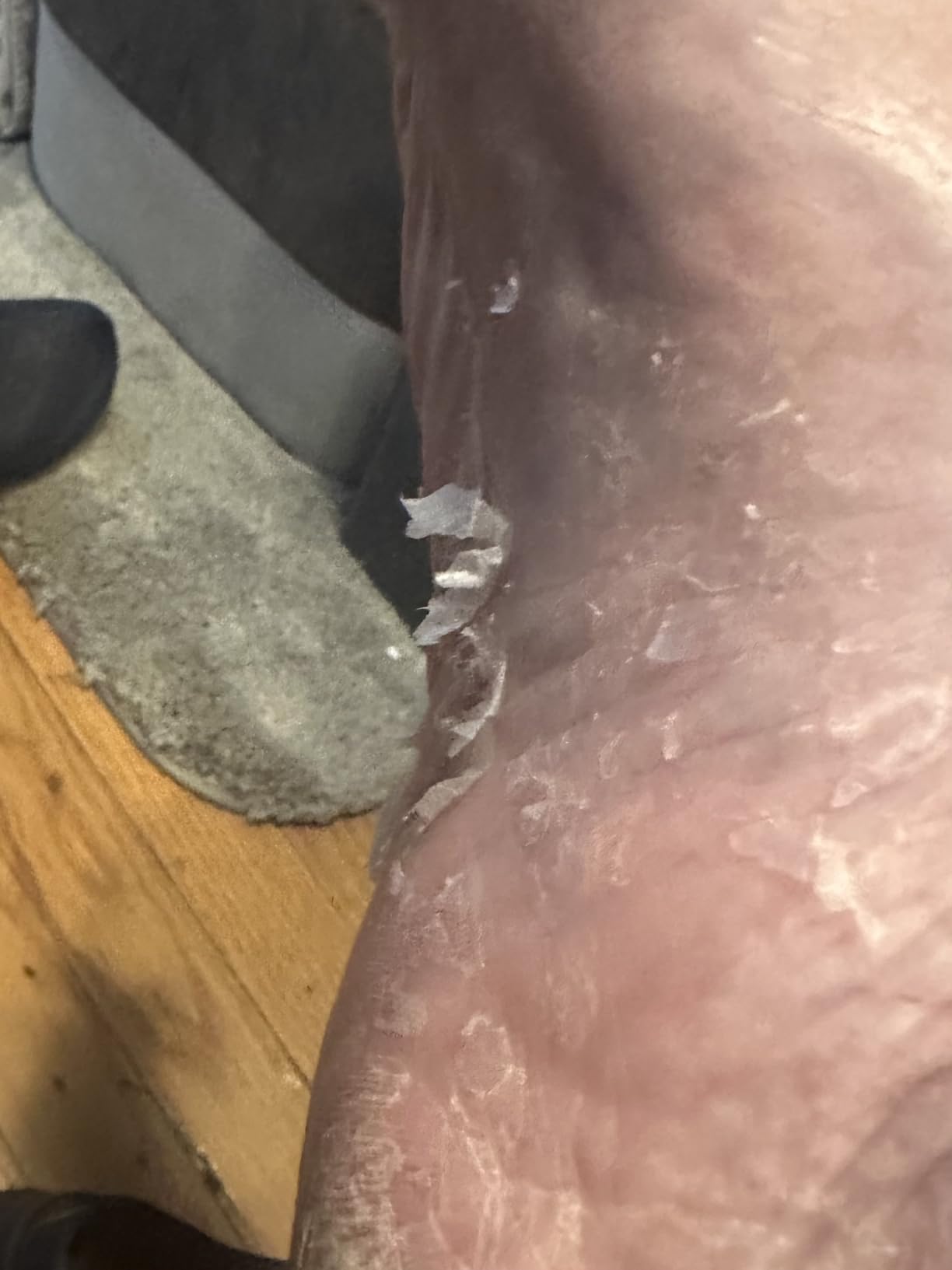 Vitamasques Foot Peeling Mask - 5 Pairs Professional Korean Exfoliating Foot Mask for Dry Cracked Feet & Callus Removal, Feet Peeling Masks that Remove Dead Skin for Soft Heels with AHA BHA PHA customer photo 1