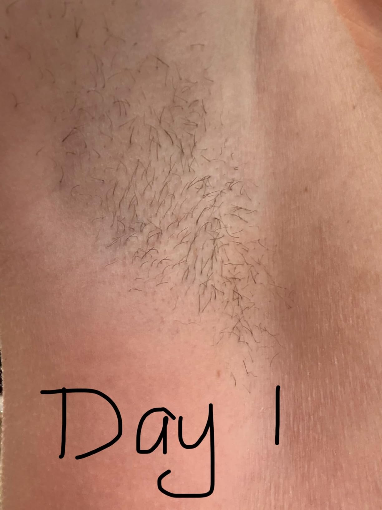 SmoothSkin Pure Adapt IPL Laser Hair Removal Device - At-Home Permanent Hair Reduction, Fast & Effective Result, Patented Smart Skin Tone Sensor, Green customer photo 2
