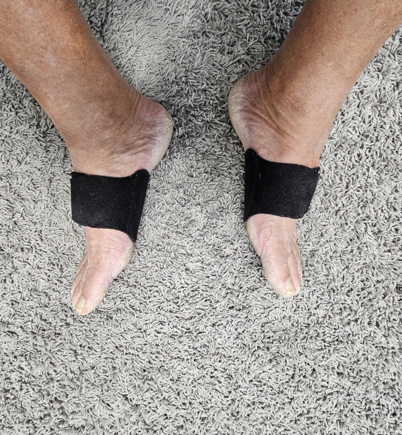 HiRui Arch Support Braces (Pair) for Plantar Fasciitis Relief - Adjustable Neoprene Arch Support Wraps with Gel Pads for Flat Feet High & Fallen Arch, Wear Over or Under Socks, Fits All Shoes (Black) customer photo 1