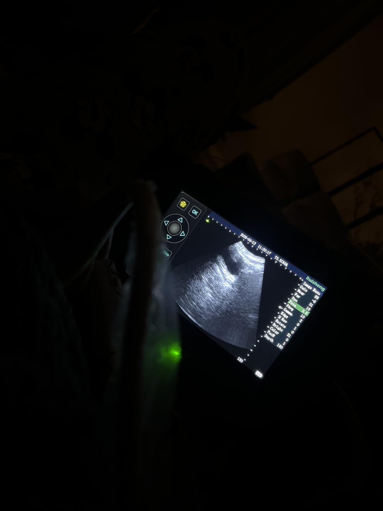 T1 Portable Veterinary Ultrasound Machine with an 8-inch Touchscreen and a 3.5MHz Convex Probe for Dog Kennels, Pig Farm and Sheep Farm Pregnancy Check (Detection Depth 4-8 inches) customer photo 1