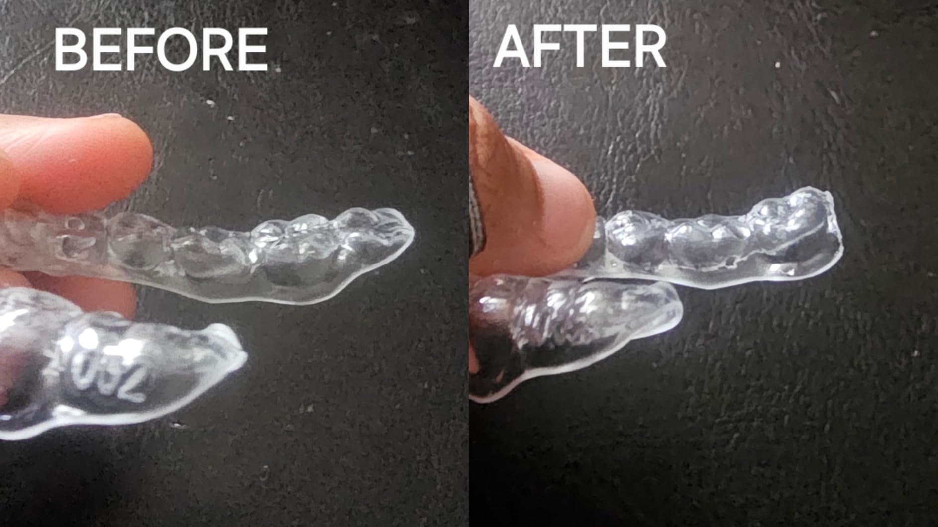 Custom Clear Retainers - Invisible Teeth Retainer for Adults & Teens - Comfortable & Durable Orthodontic Retainer customer photo 1