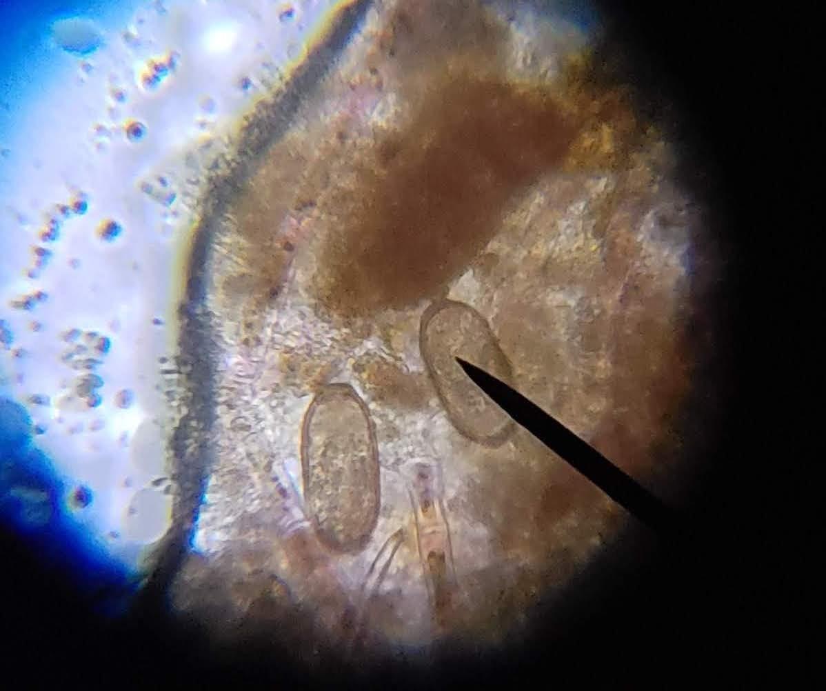 AmScope M150C 40X-1000X All-Metal Optical Glass Lenses Cordless LED Student Biological Compound Microscope customer photo 1