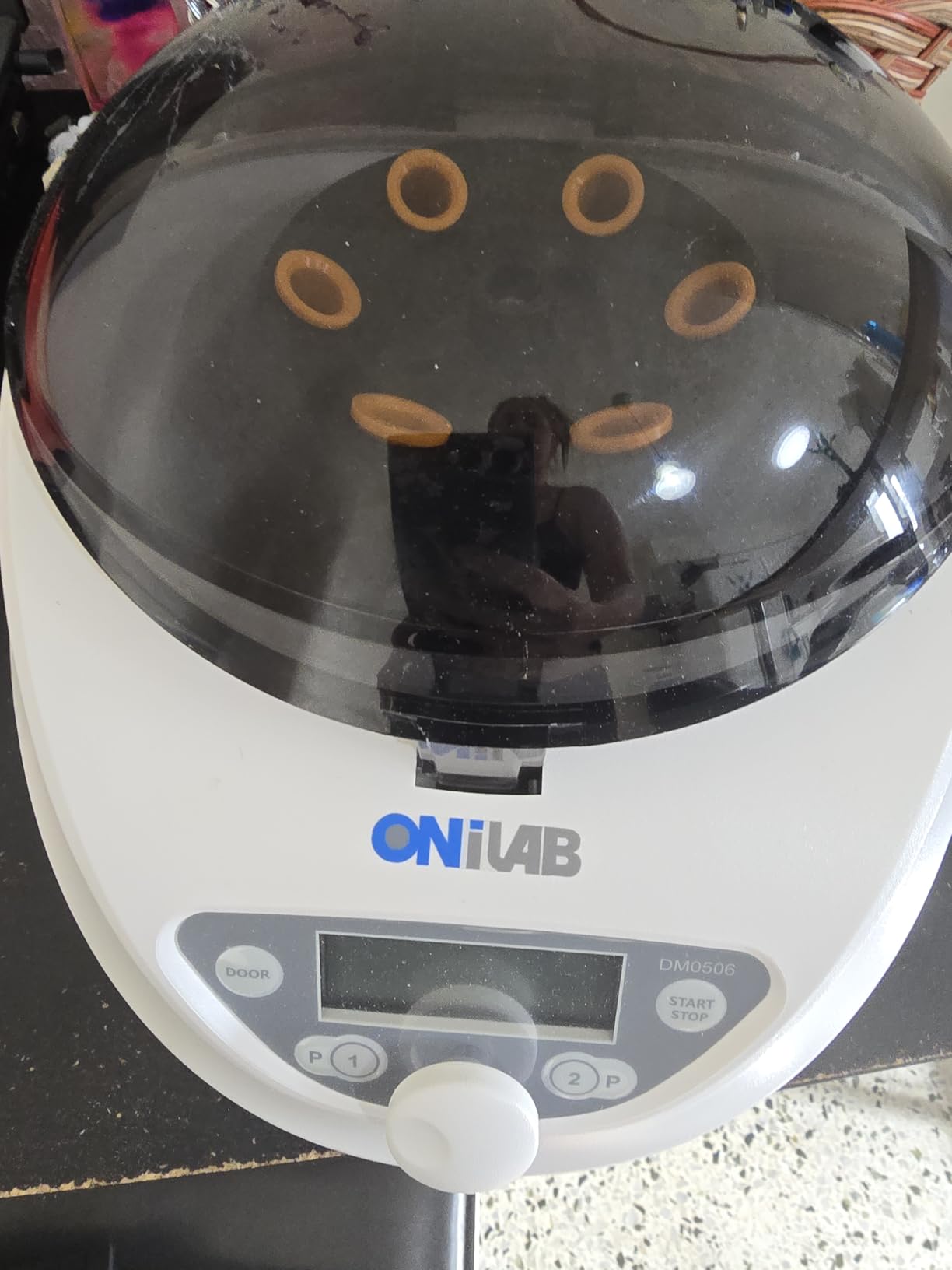 ONiLAB Professional PRP Centrifuge Machine 15mLx8, 10mL/7mL/1.5-5mlx 12, Lab Benchtop Centrifuge, 3 Preloaded Programs for Fast Operation, Store 9 Programs, 30sec-99min, 300-4500rpm (Max. 2490xg) customer photo 1