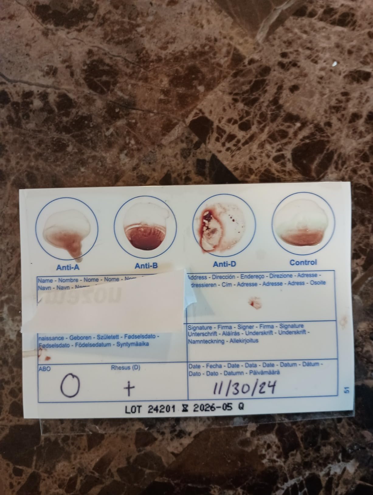 Eldoncard Blood Typing Kit, 5 Test Pack, Know Your Blood Type, Accurate Instant Home Testing, Determine A, O, B, Rhs-D Negative & Positive Groups customer photo 1
