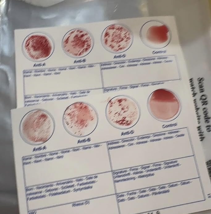 Eldoncard INC Blood Type Test, 1 Pack | Complete Kit, A, B, O, AB & RH Results, Results in Minutes, Includes Safety Lancet, Micropipette, Cleansing Swab customer photo 1