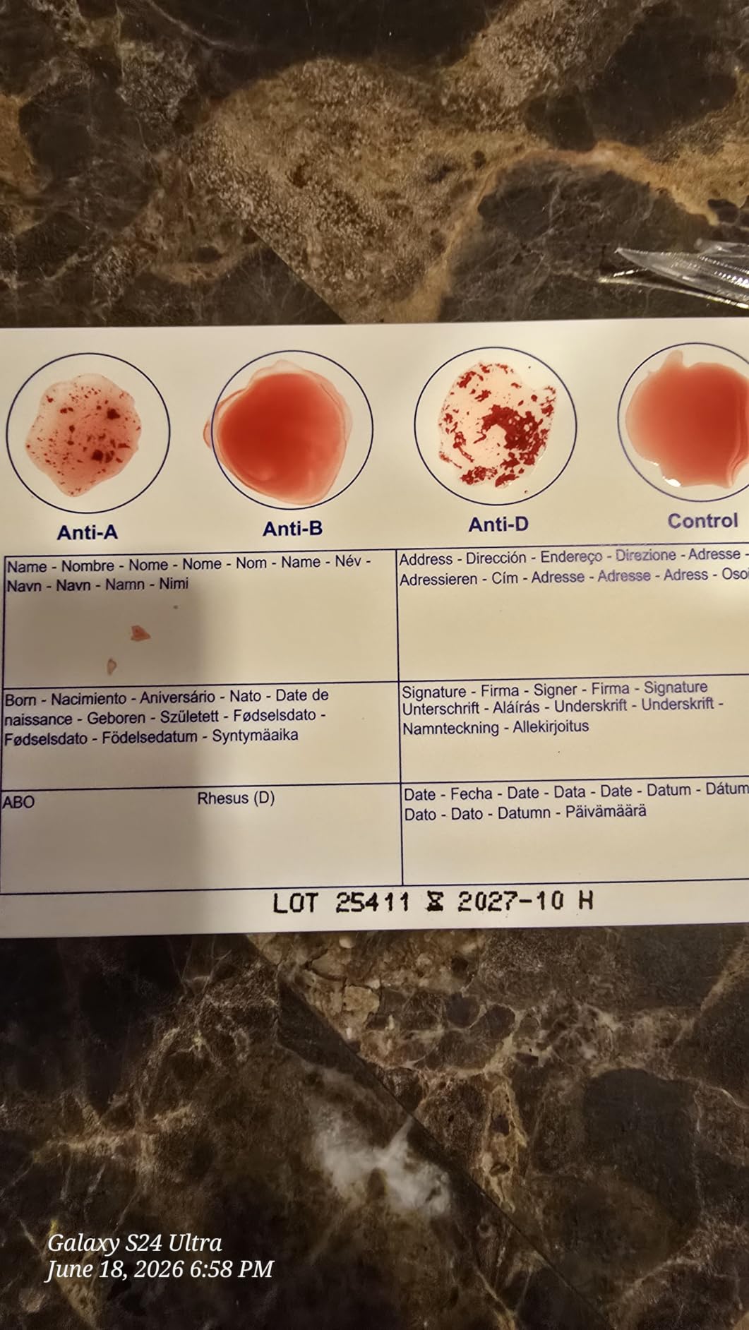 Eldoncard INC Blood Type Test, 1 Pack | Complete Kit, A, B, O, AB & RH Results, Results in Minutes, Includes Safety Lancet, Micropipette, Cleansing Swab customer photo 2