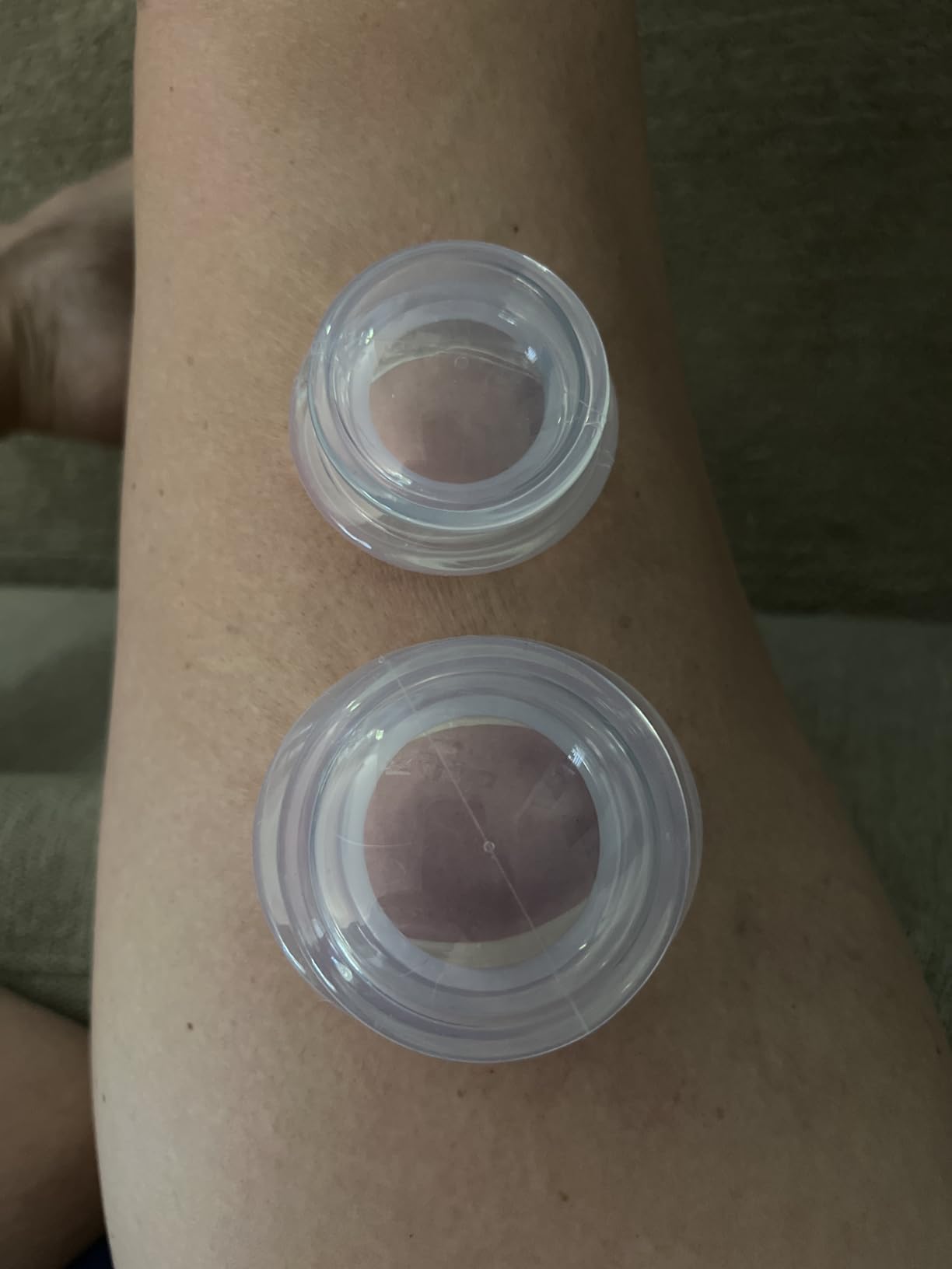 ELERA Silicone Cupping Therapy Set, Professionally Chinese Massage Cups for Cupping Therapy and Cellulite Reduction (7 Cups) customer photo 2