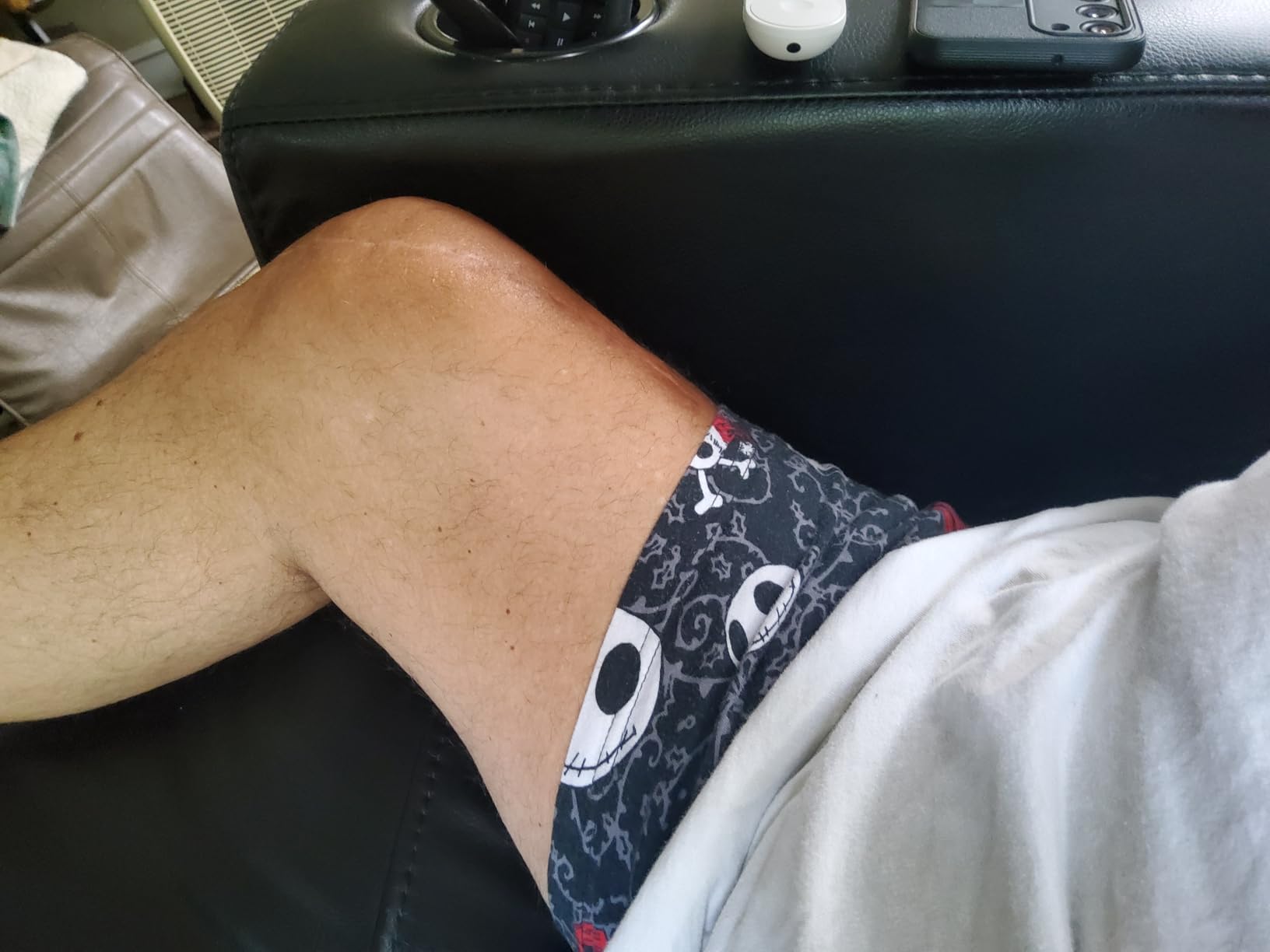 MCombo Oversized Power Lift Recliner Chair for Big and Tall People R7177 customer photo 2