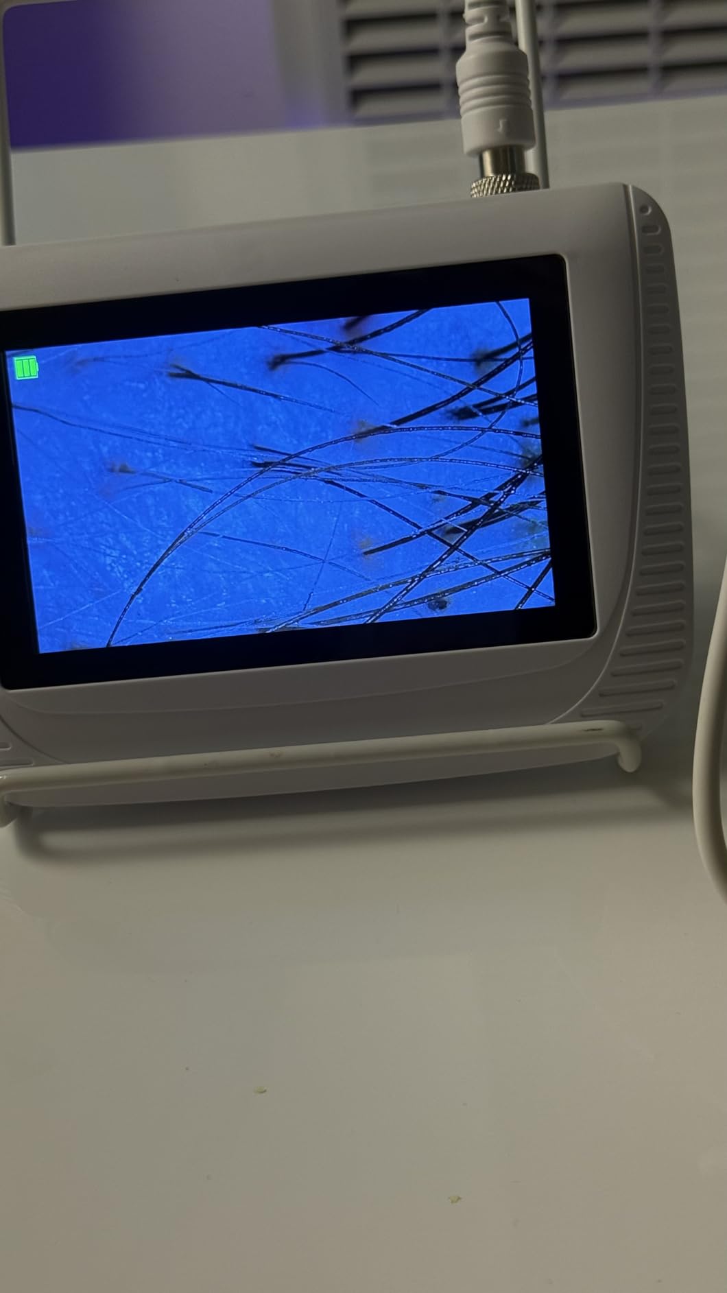 Scalp Analysis Machine, 5 Inch LCD Screen Skin Hair Analyzer customer photo 2