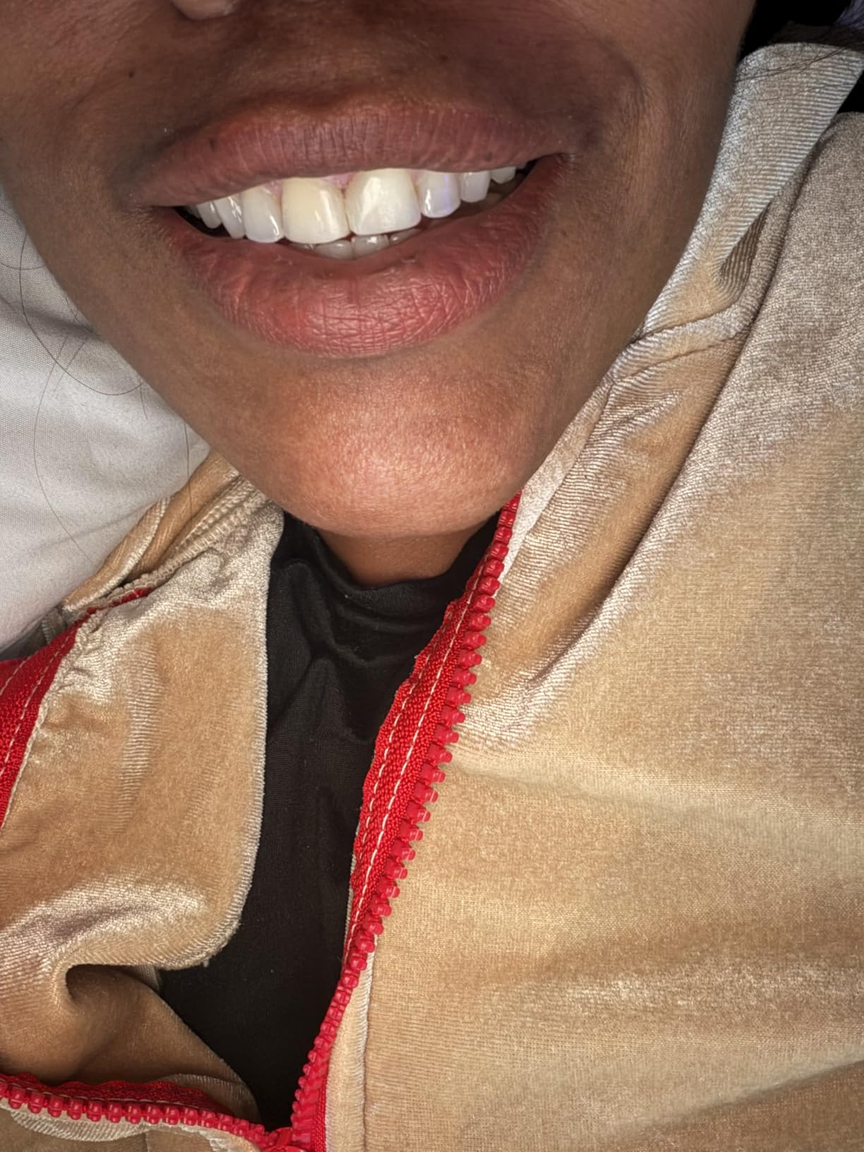 GuruNanda Teeth Whitening Kit, Up to 10 Shades Whitening, 40 Treatments | Wireless LED Accelerator Teeth Whitener | 8% Hydrogen Peroxide Teeth Whitening Gel Pen & Teeth Whitening Strips customer photo 1