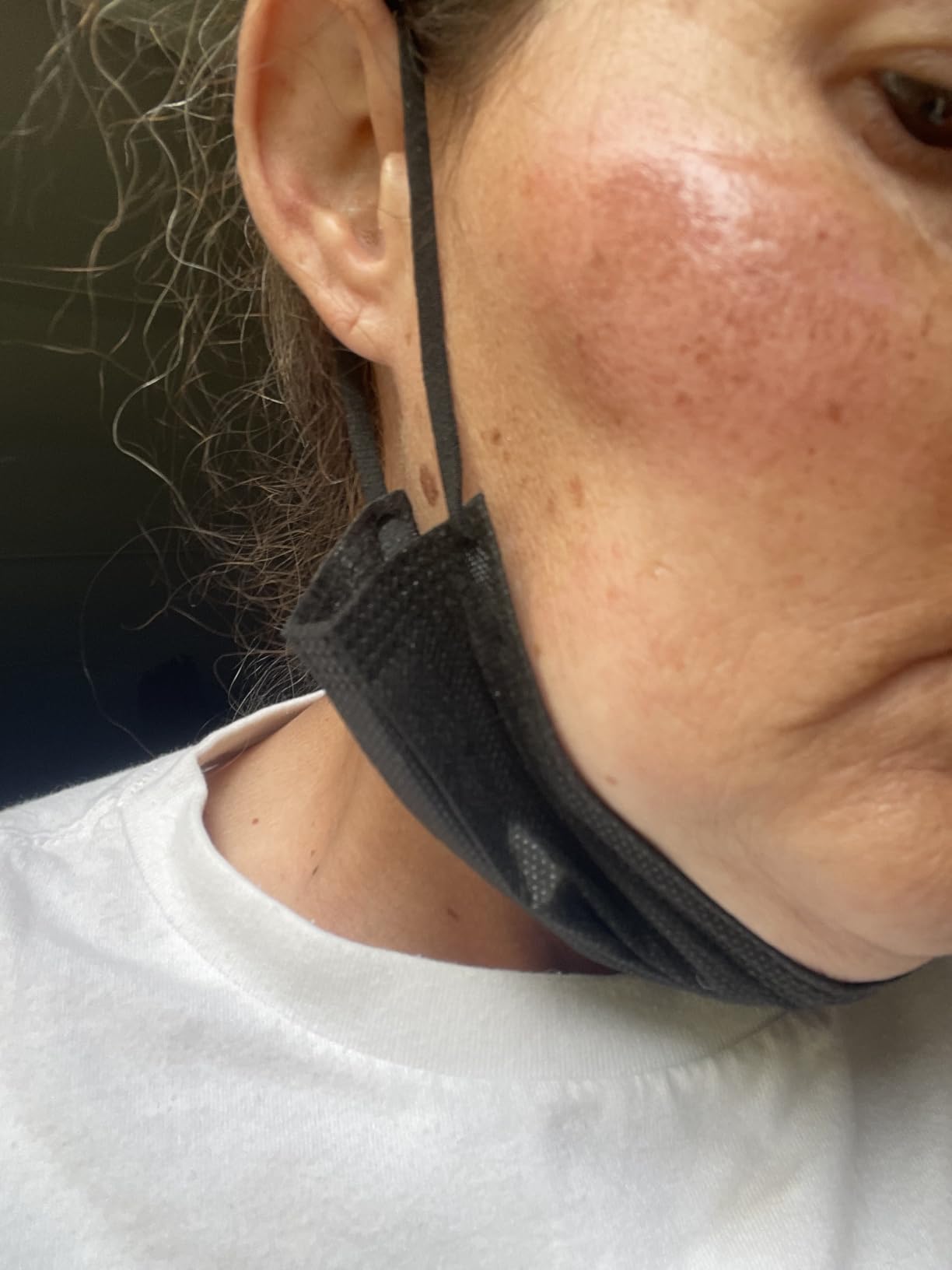 UMICKOO Rechargeable Rotating Face Scrubber customer photo 2